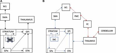 An Overview of Acoustic-Based Interventions to Improve Motor Symptoms in Parkinson’s Disease